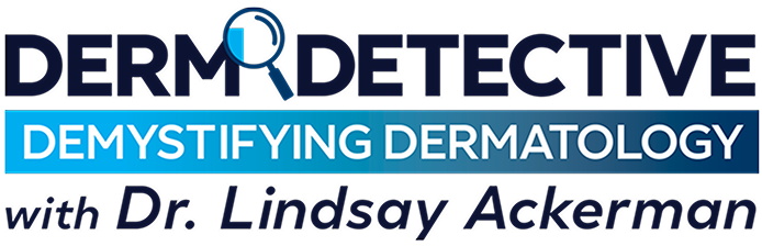 Logo for 'DERM DETECTIVE: Demystifying Dermatology with Dr. Lindsay Ackerman,'with a magnifying glass over the 'O' in 'DETECTIVE'.